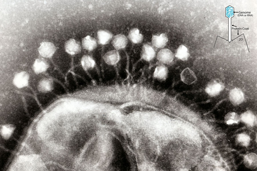 Das Bild zeigt eine schwarzweiße Rasterelektronenmikroskopaufnahme eines Bakteriums, das wie ein Halbkreis aussieht. An der Krümmung oben hängen zahlreiche kleine weiße Bakteriophagen an Fäden.