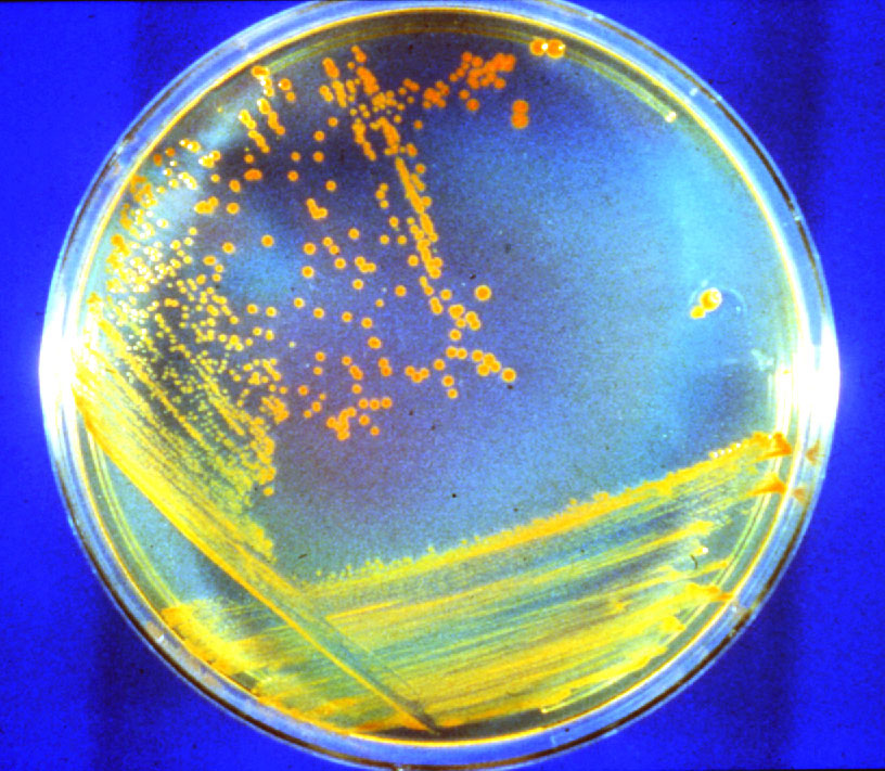 Eine Kultur des Deinococcus radiodurans: Vor einem blauen Hintergrund ist ein rundes Glas mit gelben Streifen und orangefarbenen Punkten zu sehen.